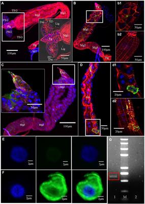 The Infection Route of Tomato Zonate Spot Virus in the Digestive System of Its Insect Vector Frankliniella occidentalis